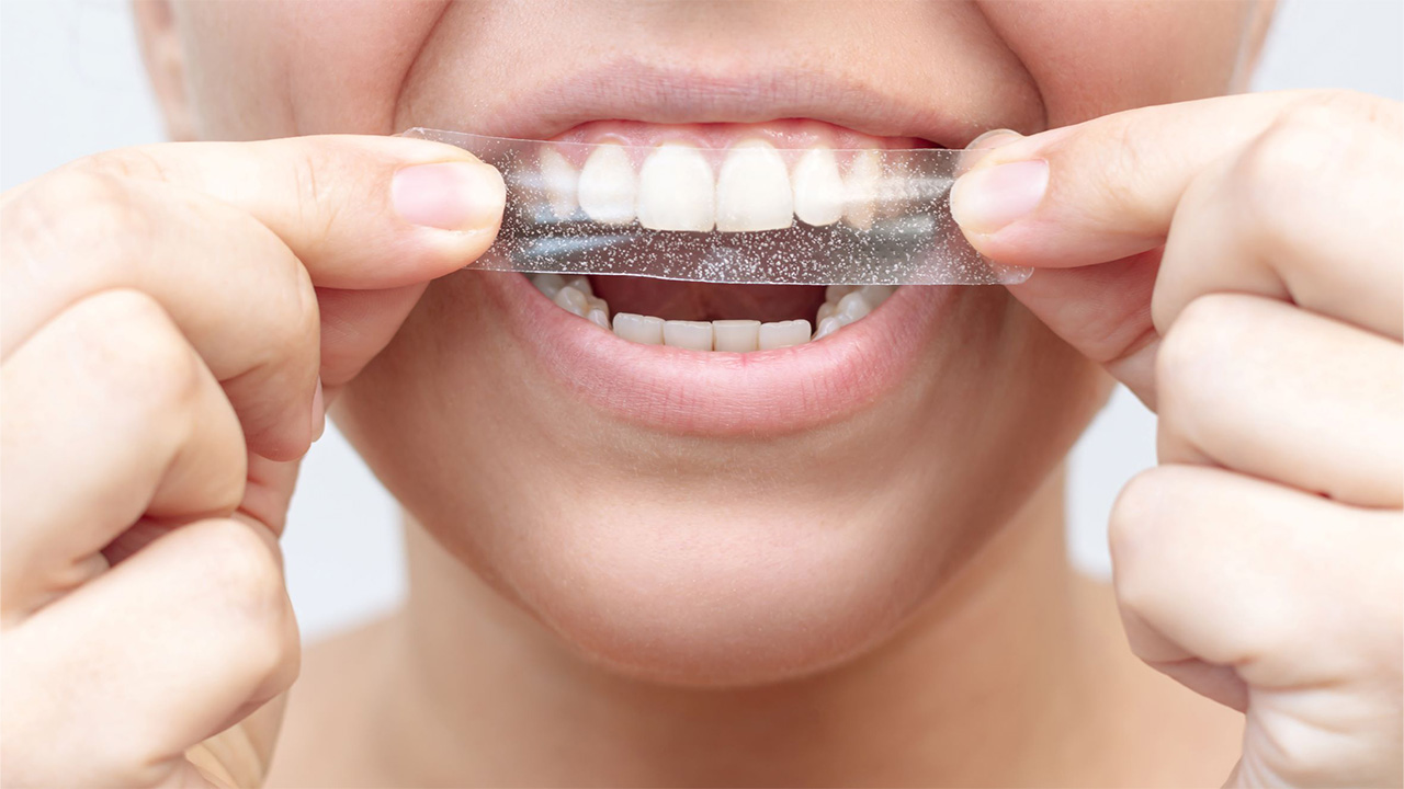 Teeth Whitening Trouble: What Happens if I Use Too Much Product?