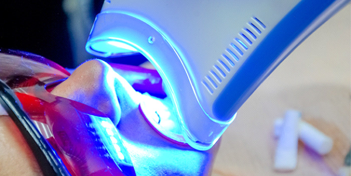 Patient in Baytown using in-office whitening